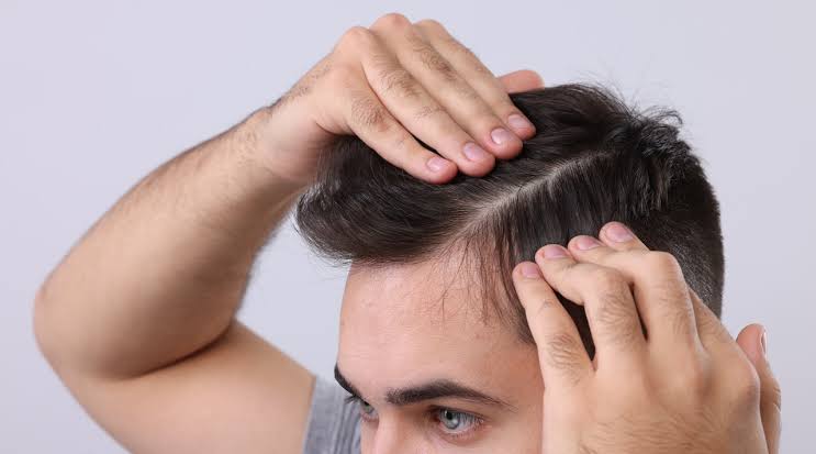 Hair Fall / Dandruff Treatment (5 Session) Men